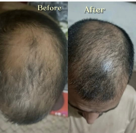 PROTECTION ALL PLUS (shampoo+hair oil+cream)