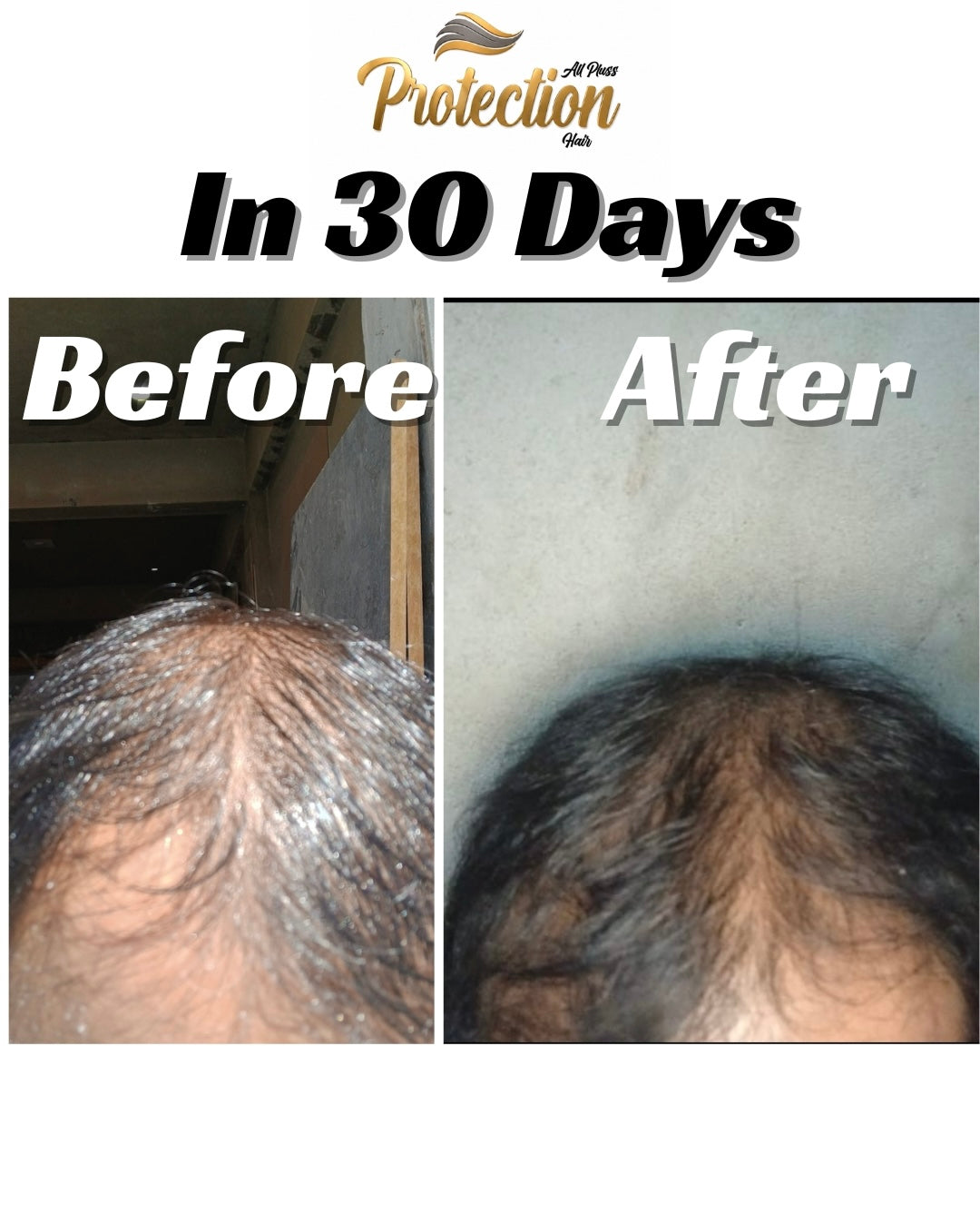 PROTECTION ALL PLUS (shampoo+hair oil+cream)