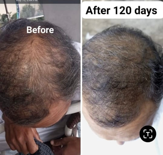PROTECTION ALL PLUS (shampoo+hair oil+cream)